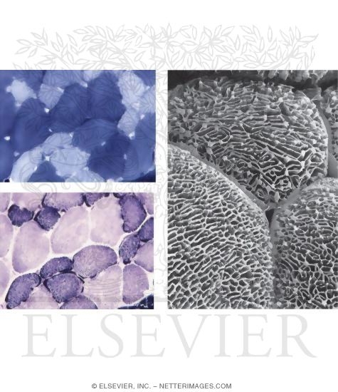 Watermarked preview of unlabeled image: Serial Transverse Frozen Sections of Skeletal Muscle With High Resolution Scanning Electron Micrograph of the Three Fiber Types of Skeletal Muscle In Transverse Section