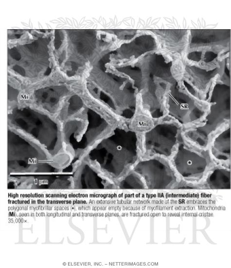 Watermarked preview of labeled image: High Resolution Scanning Electron Micrograph of Part of a Type IIA (Intermediate) Fiber Fractured In the Transverse Plane