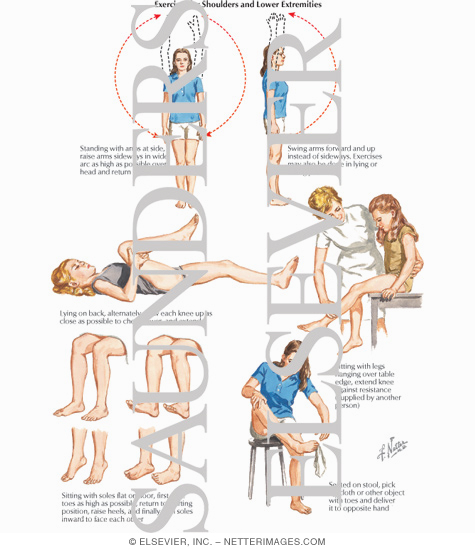 Watermarked preview of labeled image: Exercises for the Shoulders and the Lower Extremities