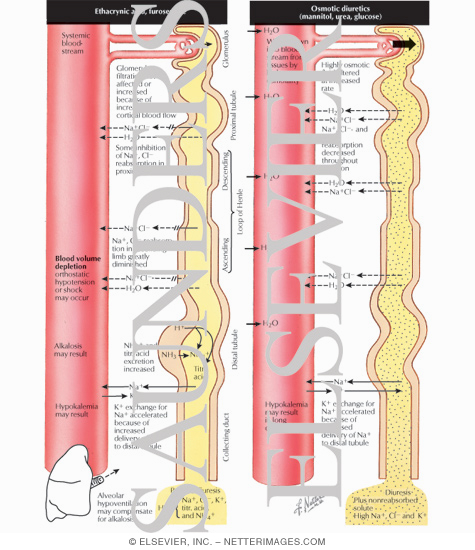 Watermarked preview of labeled image: Diuretics - Ethacrynic Acid, Furosemide; Osmotic Diuretics