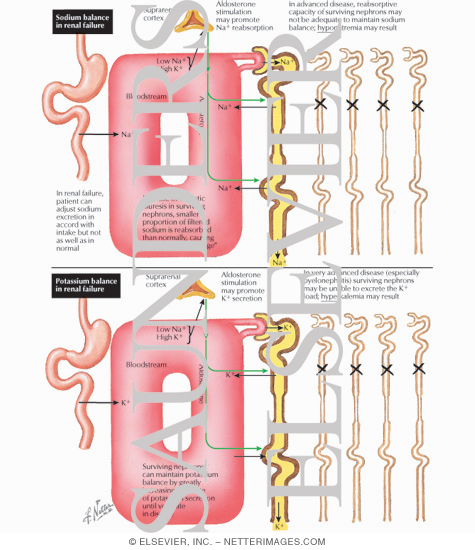 Sodium Balance in Renal Failure - Potassium Balance in Renal Failure