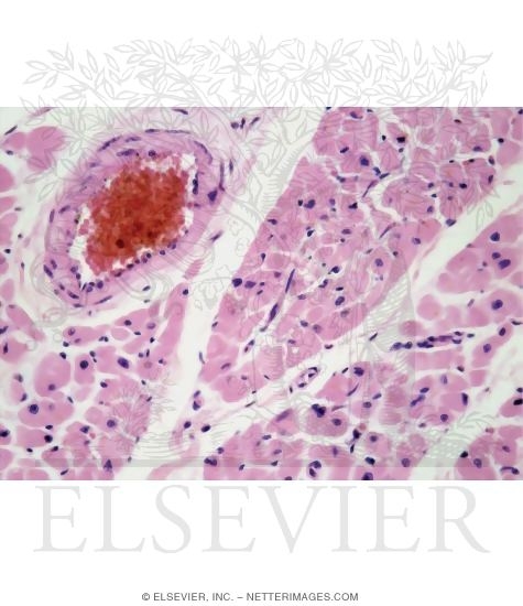 Transverse Section of Cardiac Muscle