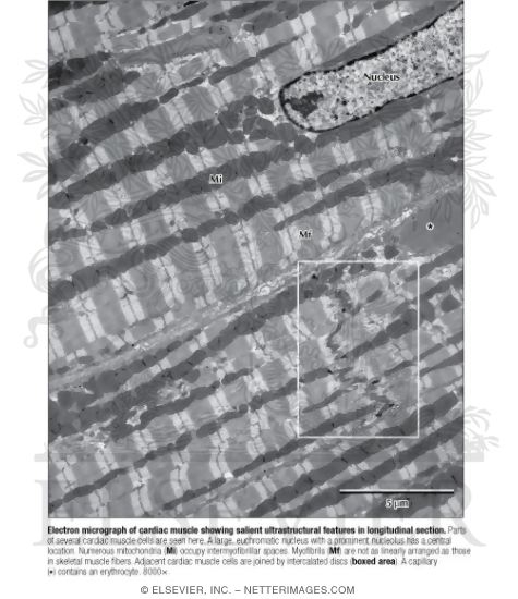 Electron Micrograph Of Cardiac Muscle Showing Salient