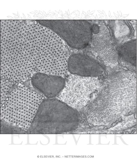 Watermarked preview of unlabeled image: Electron Micrograph of Part of a Cardiac Muscle Cell In Transverse Section