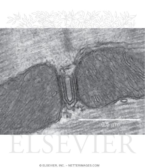 Electron Micrograph of a Dyad In a Cardiac Muscle Cell