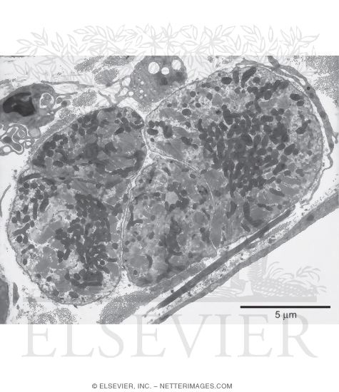 Electron Micrograph of Purkinje Fibers In Transverse Section
