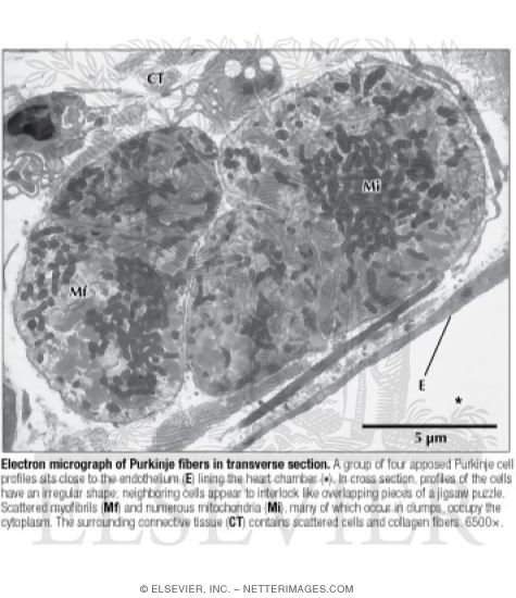 Watermarked preview of labeled image: Electron Micrograph of Purkinje Fibers In Transverse Section