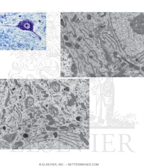 Light Micrograph of an Anterior Motor Neuron In the Spinal Cord With Electron Micrographs Showing Ultrastructural Features of the Neuron Soma