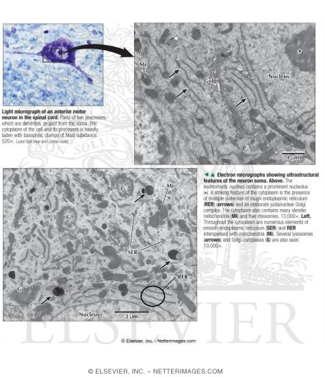 Light Micrograph of an Anterior Motor Neuron In the Spinal Cord With Electron Micrographs Showing Ultrastructural Features of the Neuron Soma