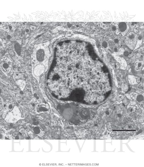 Electron Micrograph of a Microglial Cell In the Brain