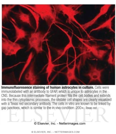 Watermarked preview of labeled image: Immunofluoresence Staining of Human Astrocytes In Culture