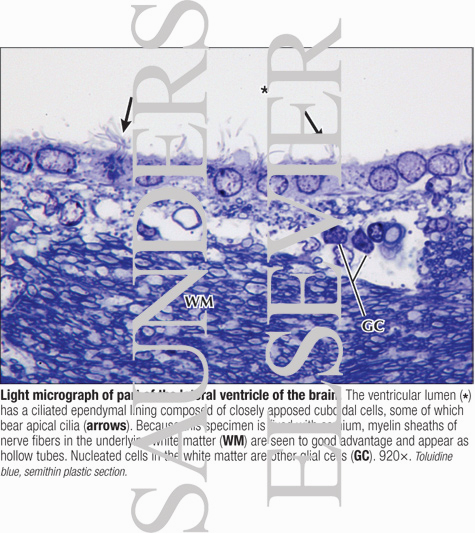 Watermarked preview of labeled image: Light Micrograph of Part of the Lateral Ventricle of the Brain