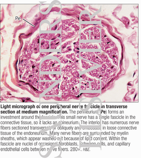 Watermarked preview of labeled image: Light Micrograph of One Peripheral Nerve Fascicle In Transverse Section at Medium Magnification