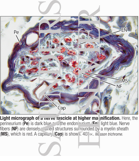 Watermarked preview of labeled image: Light Micrograph of a Nerve Fascicle at Higher Magnification