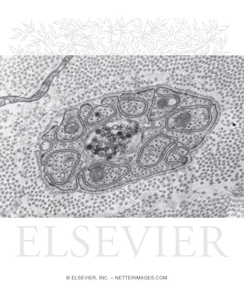 Watermarked preview of unlabeled image: Electron Micrograph of a Schwann Cell Associated With Several Unmyelinated Nerve Fibers In Transverse Section