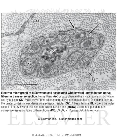 Watermarked preview of labeled image: Electron Micrograph of a Schwann Cell Associated With Several Unmyelinated Nerve Fibers In Transverse Section