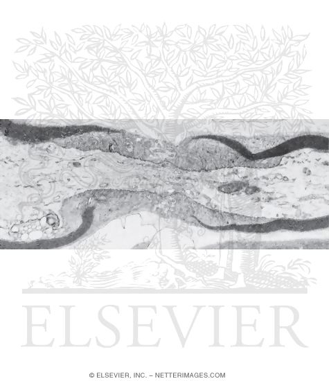 Electron Micrograph of a Node of Ranvier In Longitudinal Section