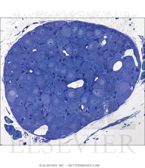 Watermarked preview of unlabeled image: Light Micrograph of a Prevertebral Ganglion Associated With the Aorta