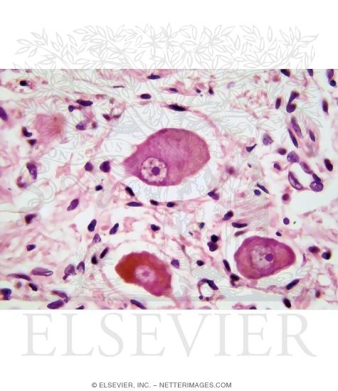 Watermarked preview of unlabeled image: Light Micrograph of Part of a Sympathetic Ganglion