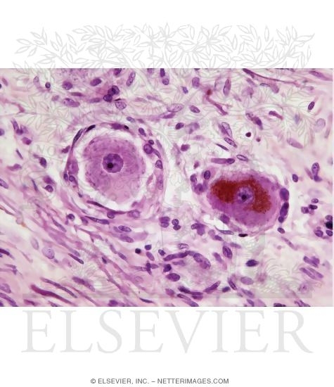 Light Micrograph of Part of a Dorsal Root Ganglion