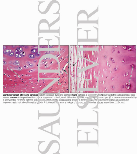 Watermarked preview of labeled image: Light Micrograph of Hyaline Cartilage
