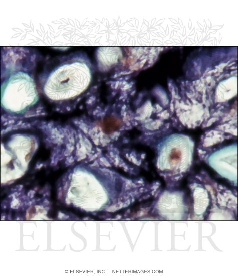 Higher Magnification LM of Elastic Cartilage Showing the Arrangement of Elastic Fibers In the Matrix