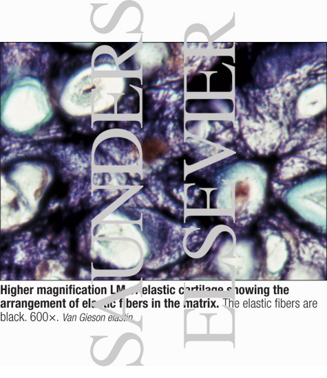 Watermarked preview of labeled image: Higher Magnification LM of Elastic Cartilage Showing the Arrangement of Elastic Fibers In the Matrix