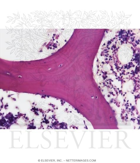 Watermarked preview of unlabeled image: Light Micrograph of Mature Spongy Bone Showing Part of a Bony Trabecula