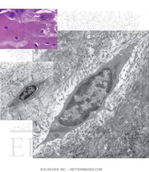 Watermarked preview of unlabeled image: Light Micrograph of Bone With Electron Micrographs of Osteocytes In Decalcified Sections of Bone