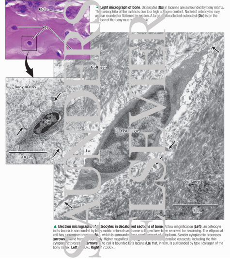 Light Micrograph of Bone With Electron Micrographs of Osteocytes In Decalcified Sections of Bone