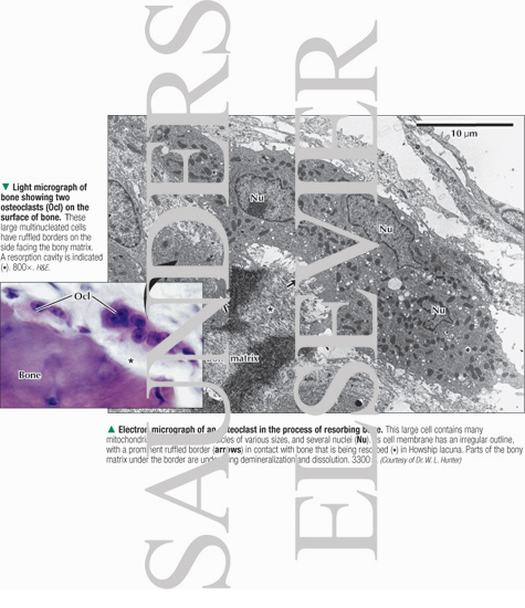 Watermarked preview of labeled image: Light Micrograph of Bone Showing Two Osteoclasts With Electron Micrograph of an Osteoclast In the Process of Resorbing Bone