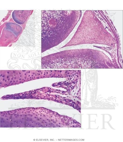 Watermarked preview of unlabeled image: Low-magnification Light Micrograph of a Rat Knee Joint With Medium Magnification Light Micrograph of Part of a Rat Knee Joint and High Magnification Light Micrograph Showing Details of a Synovial Villus and the Synovium