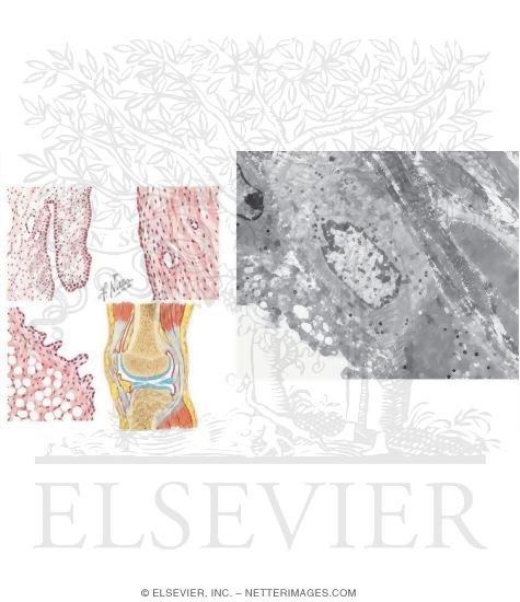 Watermarked preview of unlabeled image: Structure of the Synovium With Electron Micrograph of Fibrous Synovium