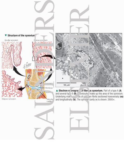 Watermarked preview of labeled image: Structure of the Synovium With Electron Micrograph of Fibrous Synovium