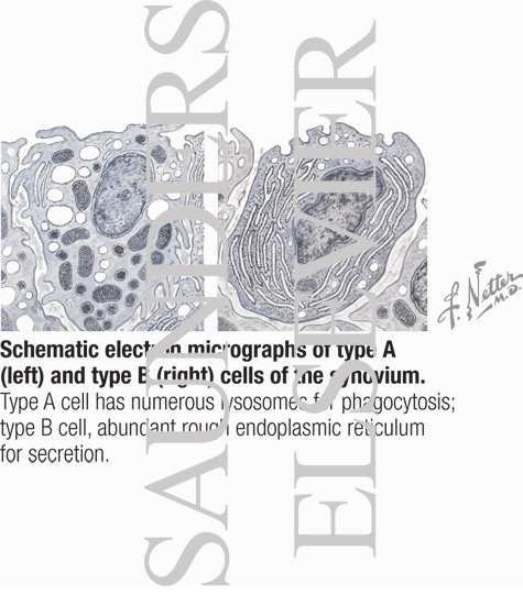 Watermarked preview of labeled image: Schematic Electron Micrographs of Type A (left) and Type B (right) Cells of the Synovium