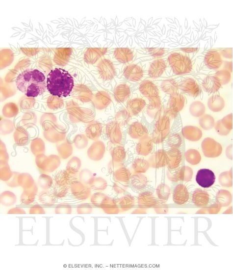 Light Micrograph of a Blood Smear Showing Typical Erythrocytes and Leukocytes