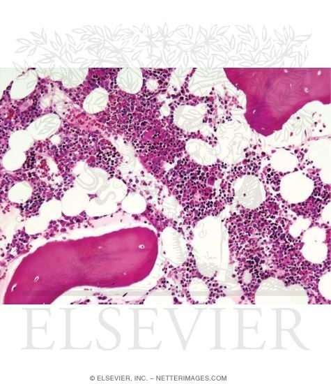 Light Micrograph of Bone Marrow Obtained Via Needle Biopsy From the Medullary Cavity of the Iliac Crest