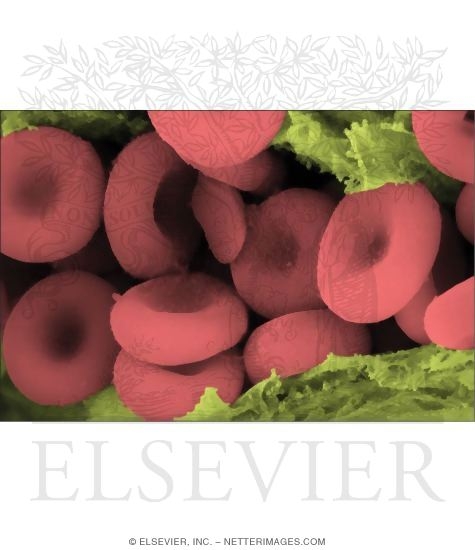 Colorized Scanning Electron Micrograph of Erythrocytes In the Lumen of a Capillary