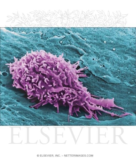 Watermarked preview of unlabeled image: Colorized Scanning Electron Micrograph Showing a Venule Lumen