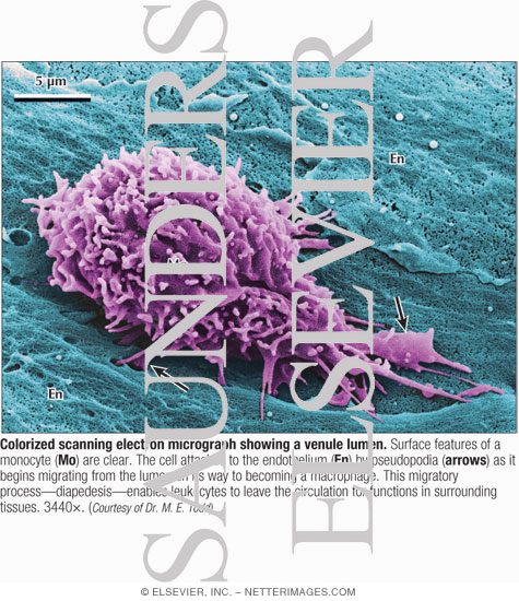 Watermarked preview of labeled image: Colorized Scanning Electron Micrograph Showing a Venule Lumen