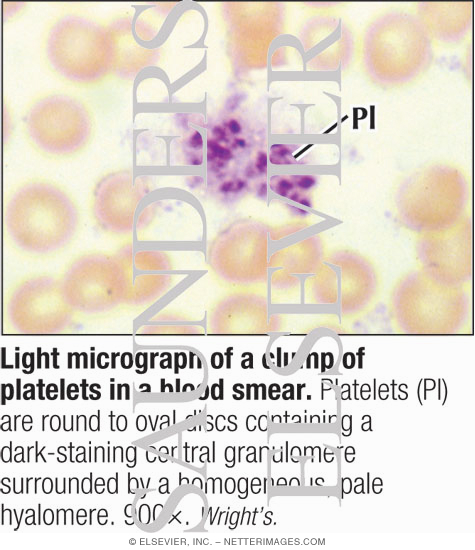 Light Micrograph of a Clump of Platelets In a Blood Smear