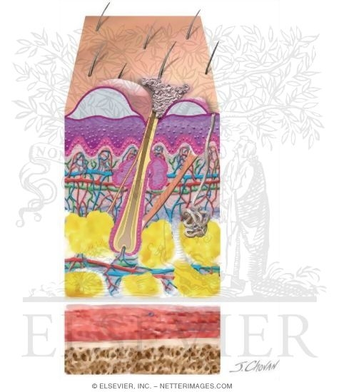 Cross-Section of the Skin Showing Layer and Types of Infections