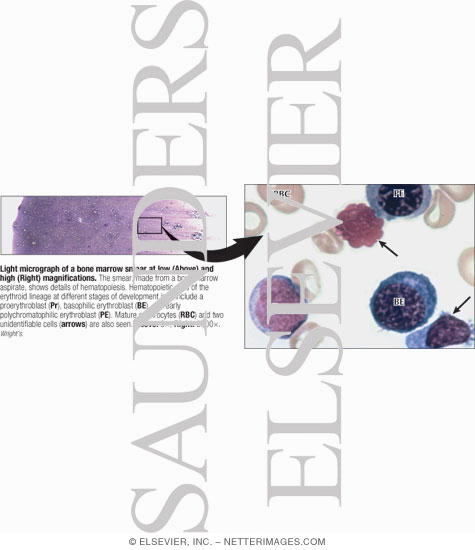 Watermarked preview of labeled image: Light Micrograph of a Bone Marrow Smear at Low (Above) and High (Right) Magnifications