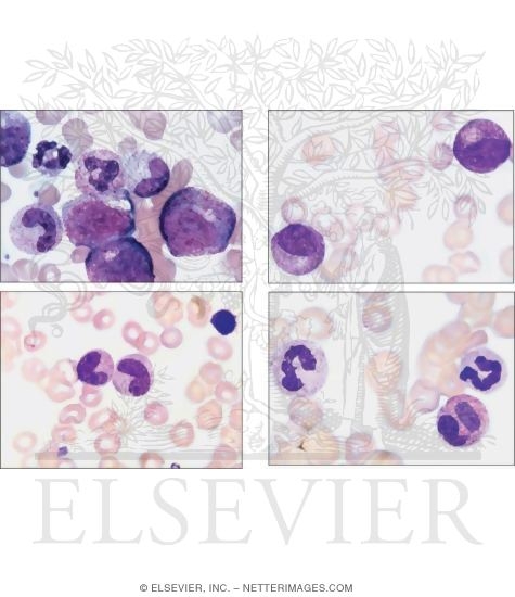 Watermarked preview of unlabeled image: Bone Marrow Smears Showing Different Stages of Granulocytopoiesis