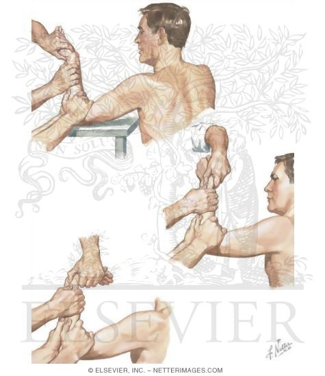 Colles' Fracture: Reduction By Manipulation