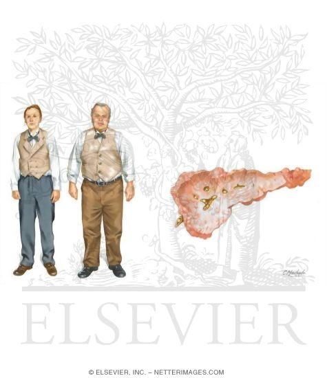 Watermarked preview of unlabeled image: Comparson of Thin Vs. Overweight Males