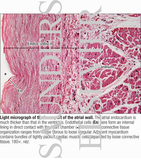 Watermarked preview of labeled image: Light Micrograph of the Inner Part of the Atrial Wall