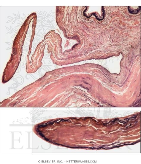 Light Micrograph Of Part Of The Aortic Semilunar Valve With