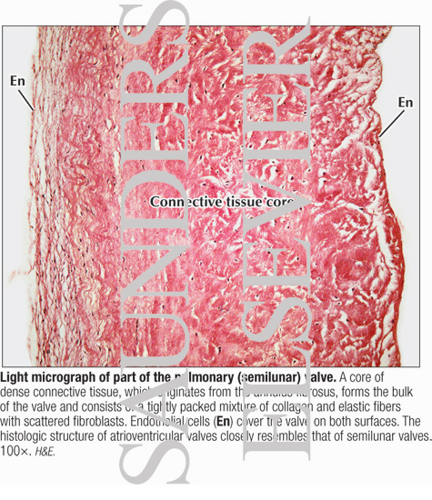 Atrioventricular Valve Histology Atrioventricular Valve Histology