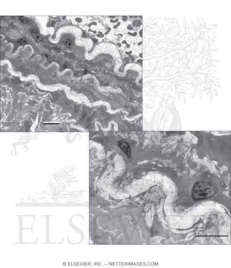 Watermarked preview of unlabeled image: Electron Micrographs of Parts of the Aortic Wall at Low (Left) and Medium (Below) Magnification
